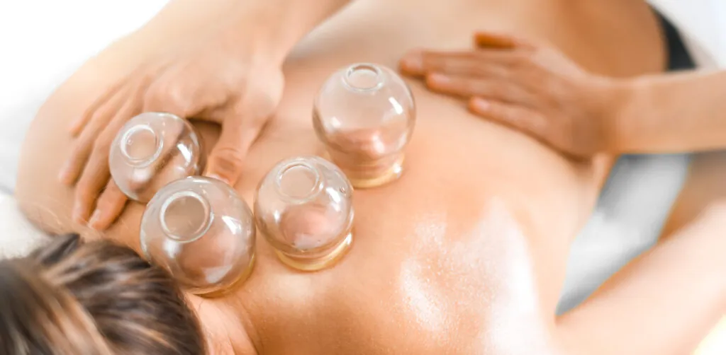 Detail of a woman therapist hands giving cupping treatment on back.